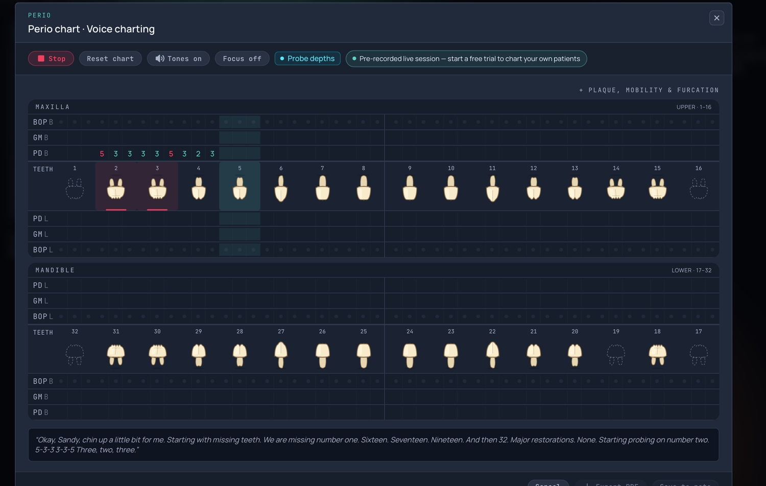 A perio chart being filled by voice, with the current tooth highlighted