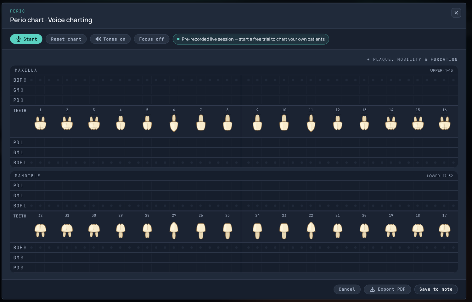 The empty perio chart, showing depth, recession and bleeding rows for both arches